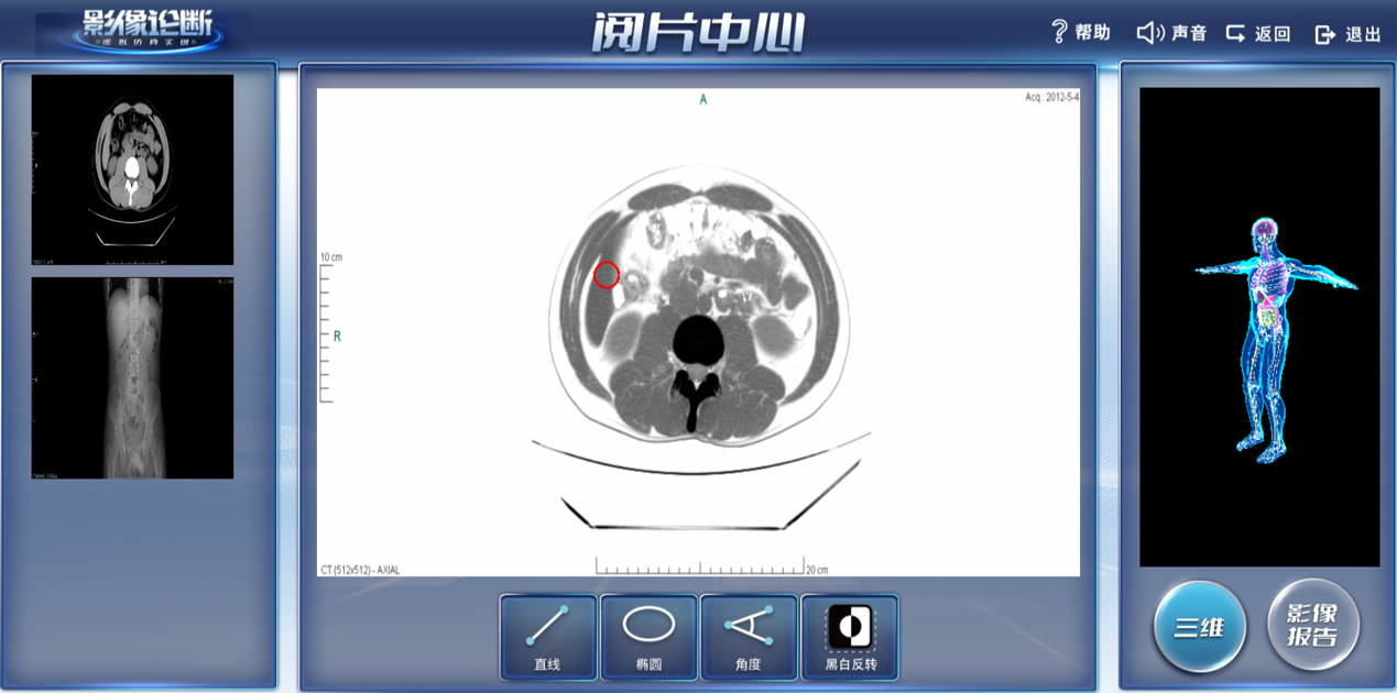 影像診斷虛擬仿真系統(tǒng)